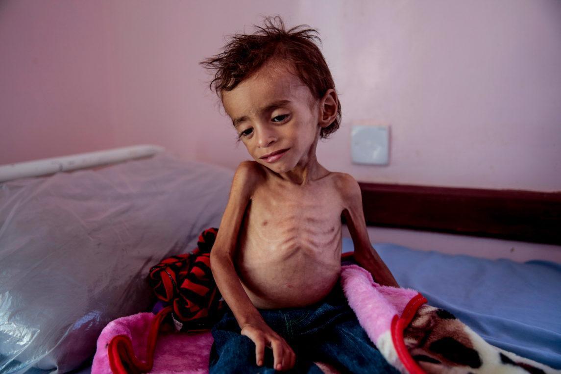 Kelaparan di Yaman, Yaman, Perang Yaman