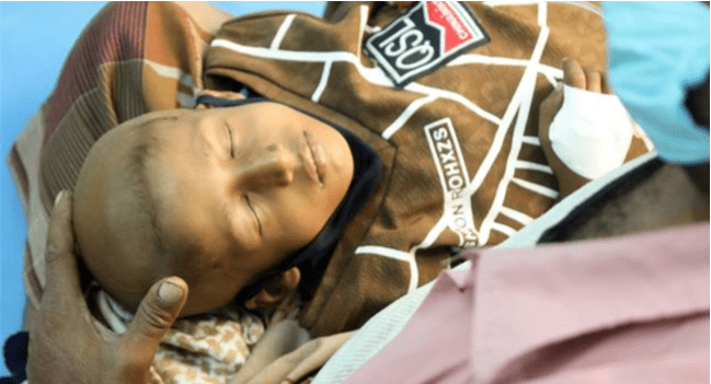 Menkes Yaman: Ribuan Pasien Beresiko Meninggal Akibat Blokade Koalisi Saudi