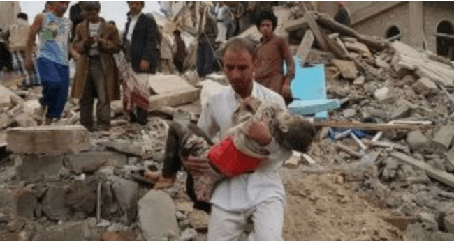 Inilah Tragedi Yaman Yang Disembunyikan Dunia